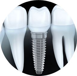 flikier-dental-clinic-implants-home-02-02