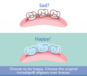 Align Dental Technology Invisalign