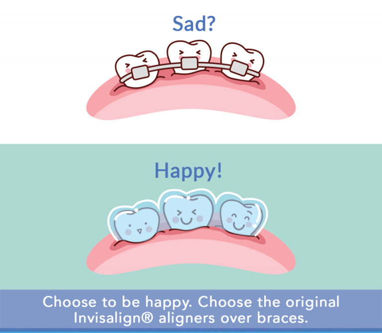 Align Dental Technology Invisalign