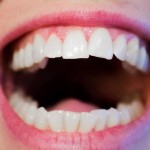 All on 8 dental Costa Rica